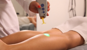 Does laser hair removal hurt