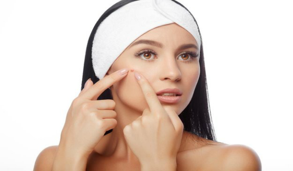 Get rid of Blackheads On Cheeks