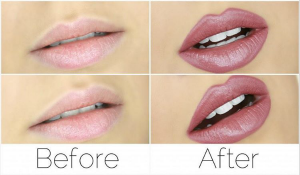 how to plump lips